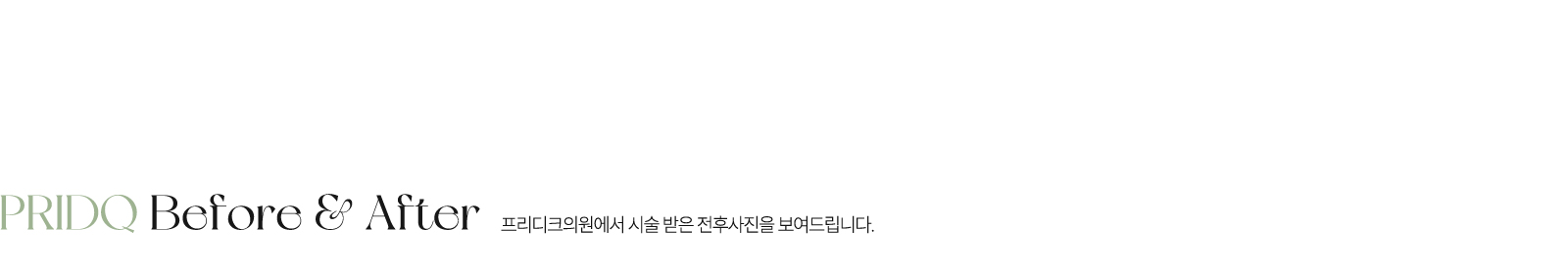 프리디크 전후사진